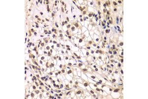 Immunohistochemistry (Paraffin-embedded Sections) (IHC (p)) image for anti-SWI/SNF Related, Matrix Associated, Actin Dependent Regulator of Chromatin, Subfamily C, Member 1 (SMARCC1) (AA 80-320) antibody (ABIN6148109)