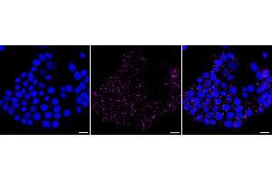 Immunocytochemical staining of HeLa cells with ERK5 antibody (ABIN7799456), 1:1,000). (Rekombinanter MAPK7 Antikörper)