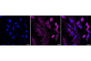 Immunocytochemical staining of H9C2 cells with PHD3 antibody (ABIN7798427), 1:1,000).