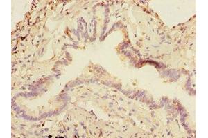 Immunohistochemistry of paraffin-embedded human lung tissue using ABIN7160270 at dilution of 1:100 (DCP1A Antikörper  (AA 303-582))