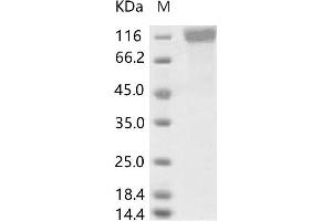 Western Blotting (WB) image for Coronavirus OC43 Spike Protein (HCoV-OC43 S) protein (His tag) (ABIN7198836) (hCoV-OC43 Spike Protein (His tag))