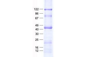 Validation with Western Blot (DEDD Protein (His tag))