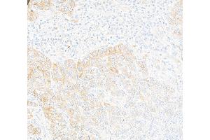 Immunohistochemistry (IHC) image for anti-HRas proto-oncogene, GTPase (HRAS) (AA 50-100) antibody (ABIN7795746)
