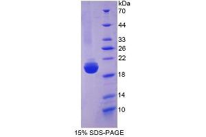 SDS-PAGE (SDS) image for Slit Homolog 2 (Drosophila) (SLIT2) (AA 1160-1333) protein (His tag) (ABIN1171387)