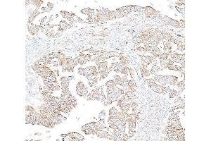 anti-Echinoderm Microtubule Associated Protein Like 4 (EML4) (AA 931-981) antibody