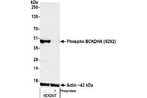Western Blotting (WB) image for anti-Branched Chain Keto Acid Dehydrogenase E1, alpha Polypeptide (BCKDHA) (pSer292) antibody (ABIN7449282) (Rekombinanter BCKDHA Antikörper  (pSer292))