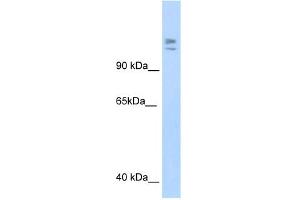 WB Suggested Anti-MYBBP1A Antibody Titration:  1. (MYBBP1A Antikörper  (C-Term))