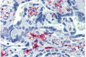 Placenta, Human: Formalin-Fixed, Paraffin-Embedded (FFPE) (CD163 Antikörper)