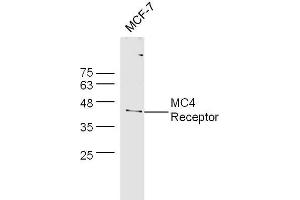 MCF-7 cell lysates probed with Rabbit Anti-MC4 Receptor Polyclonal Antibody, Unconjugated  at 1:500 for 90 min at 37˚C. (MC4R Antikörper  (AA 1-50))