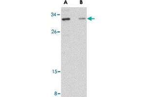 Western blot analysis of GRTP1 in SK-N-SH cell lysate with GRTP1 polyclonal antibody  at 1 ug/mL in the (A) absence and (B) presence of blocking peptide. (GRTP1 Antikörper  (Internal Region))