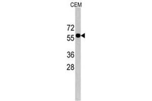 Image no. 1 for anti-CCR4-NOT Transcription Complex Subunit 4 (CNOT4) (C-Term) antibody (ABIN356969) (CNOT4 Antikörper  (C-Term))