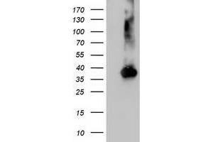 Western Blotting (WB) image for anti-Nudix (Nucleoside Diphosphate Linked Moiety X)-Type Motif 18 (NUDT18) antibody (ABIN1499861) (NUDT18 Antikörper)