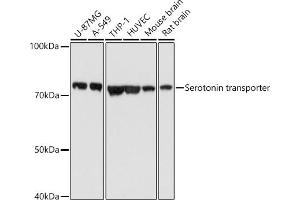 Western blot analysis of extracts of various cell lines, using Serotonin transporter antibody (ABIN7270477) at 1:1000 dilution. (SLC6A4 Antikörper  (C-Term))