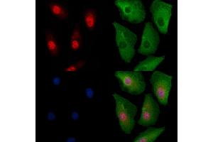 ABIN6260374 and ABIN6279100 staining  cells by IF/ICC.