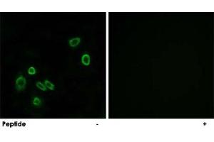 Immunofluorescence analysis of A-549 cells, using BRP44L polyclonal antibody . (BRP44L Antikörper  (Internal Region))