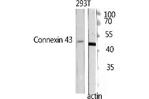 Western Blotting (WB) image for anti-Doublecortin (DCX) (Ser30) antibody (ABIN3184352) (Doublecortin Antikörper  (Ser30))