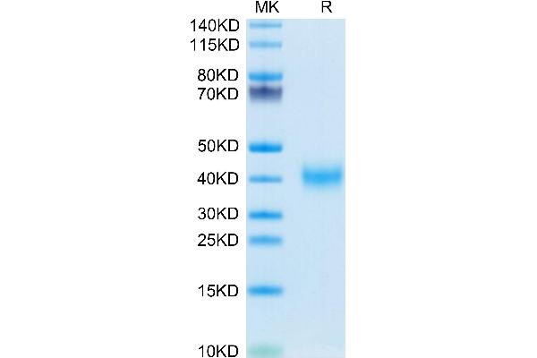 CLEC10A Protein (AA 57-304) (His tag)