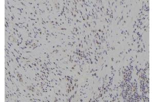 ABIN6277285 at 1/100 staining Human gastric tissue by IHC-P. (TBK1 Antikörper  (Internal Region))