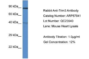 Western Blotting (WB) image for anti-Tripartite Motif Containing 3 (TRIM3) (N-Term) antibody (ABIN2787468) (TRIM3 Antikörper  (N-Term))