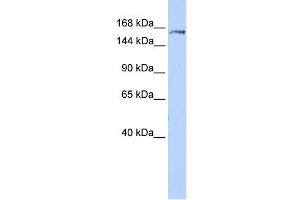 EPRS antibody used at 1 ug/ml to detect target protein. (EPRS Antikörper  (Middle Region))