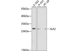 Western blot analysis of extracts of various cell lines, using SL antibody (ABIN6130692, ABIN6147825, ABIN6147826 and ABIN6216581) at 1:3000 dilution. (SLAP2 Antikörper  (AA 1-160))