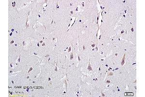 Formalin-fixed and paraffin embedded rat brain tissue labeled with Anti-CD203c Polyclonal Antibody, Unconjugated (ABIN731453) followed by conjugation to the secondary antibody and DAB staining (ENPP3 Antikörper  (AA 40-140))