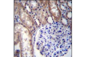 Immunohistochemistry (Paraffin-embedded Sections) (IHC (p)) image for anti-Guanine Nucleotide Binding Protein (G Protein), alpha 14 (GNa14) (AA 4-33), (N-Term) antibody (ABIN656680)