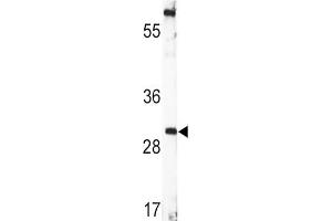 Western Blotting (WB) image for anti-Brain-Derived Neurotrophic Factor (BDNF) antibody (ABIN3003616) (BDNF Antikörper)