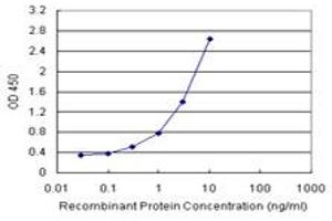 Sandwich ELISA detection sensitivity ranging from 0. (UROS (Human) Matched Antibody Pair)