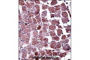 Immunohistochemistry (Formalin/PFA-fixed paraffin-embedded sections) of human skeletal muscle with RGS9 polyclonal antibody  followed by peroxidase conjugation of the secondary antibody and DAB staining. (RGS Antikörper  (AA 149-178))