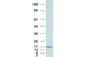 Western Blotting (WB) image for Fatty Acid Binding Protein 5 (Psoriasis-Associated) (FABP5) protein (Myc-DYKDDDDK Tag) (ABIN2720668)