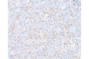 Immunohistochemistry (IHC) image for anti-Hepatitis A Virus Cellular Receptor 2 (TIM 3) (AA 22-201) antibody (ABIN7449550) (Rekombinanter TIM3 Antikörper  (AA 22-201))