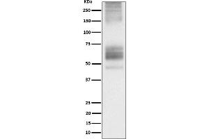 Western blot analysis of Somatostatin Receptor 1 expression in 293T transfected with Somatostatin Receptor 1 cell lysate.