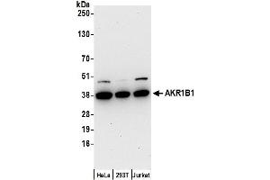 Western Blotting (WB) image for anti-Aldo-Keto Reductase Family 1, Member B1 (Aldose Reductase) (AKR1B1) (AA 1-50) antibody (ABIN7453024)