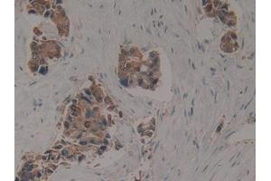 Used in DAB staining on fromalin fixed paraffin- embedded kidney tissue (KRT16 Antikörper  (AA 117-419))