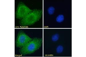 ABIN571180 Immunofluorescence analysis of paraformaldehyde fixed A549 cells, permeabilized with 0. (PLA2G4A Antikörper  (Internal Region))