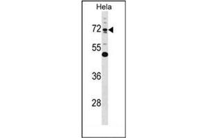 Western blot analysis of Epsin-1  Antibody  in Hela cell line lysates (35ug/lane). (Epsin 1 Antikörper  (Middle Region))