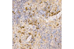 Immunohistochemistry of paraffin-embedded rat spleen using Bag1 Rabbit mAb (ABIN7265847) at dilution of 1:50 (40x lens). (BAG1 Antikörper)