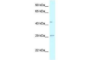 Western Blot showing FUT8 antibody used at a concentration of 1 ug/ml against Fetal Liver Lysate (FUT8 Antikörper  (N-Term))