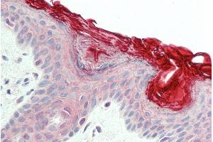 ABIN185623 (5µg/ml) staining of paraffin embedded Human Skin. (PERP Antikörper  (C-Term))