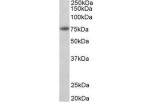 AP31949PU-N APP antibody staining of Human Cerebral Cortex lysate at 1 µg/ml (35µg protein in RIPA buffer). (APP Antikörper  (N-Term))