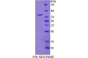 Image no. 1 for Pirin (PIR) (AA 1-290) protein (His tag) (ABIN6238384) (Pirin Protein (PIR) (AA 1-290) (His tag))