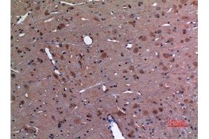 Immunohistochemistry (IHC) analysis of paraffin-embedded Rat Brain, antibody was diluted at 1:100. (UBE2A/B (C-Term) Antikörper)
