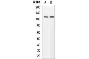 Western blot analysis of p116 Rip expression in U251MG (A), NIH3T3 (B) whole cell lysates. (MPRIP Antikörper  (Center))