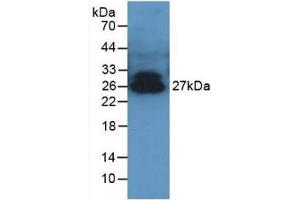 Detection of ADPN in Porcine Serum using Polyclonal Antibody to Adiponectin (ADPN) (ADIPOQ Antikörper  (AA 17-243))