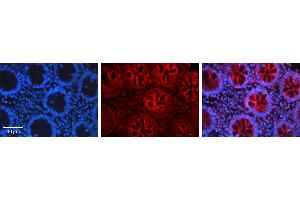 Rabbit Anti-CEBPB Antibody Catalog Number: ARP31259_P050 Formalin Fixed Paraffin Embedded Tissue: Human Appendix (Colon) Tissue Observed Staining: Cytoplasm Primary Antibody Concentration: 1:100 Other Working Concentrations: N/A Secondary Antibody: Donkey anti-Rabbit-Cy3 Secondary Antibody Concentration: 1:200 Magnification: 20X Exposure Time: 0. (CEBPB Antikörper  (C-Term))