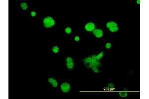 Immunofluorescence of monoclonal antibody to ATPIF1 on MCF-7 cell. (ATPase Inhibitory Factor 1 Antikörper  (AA 1-106))