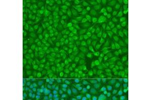Immunofluorescence analysis of U2OS cells using CHEK1 Polyclonal Antibody at dilution of 1:100. (CHEK1 Antikörper)