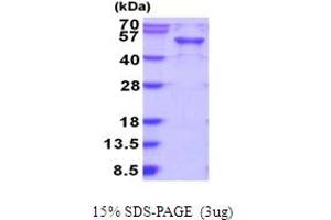 SDS-PAGE (SDS) image for RAB3A Interacting Protein (Rabin3)-Like 1 (RAB3IL1) (AA 1-382) protein (His tag) (ABIN5854004)