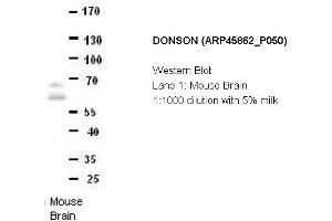 Image no. 2 for anti-Downstream Neighbor of SON (DONSON) (Middle Region) antibody (ABIN2782388) (DONSON Antikörper  (Middle Region))
